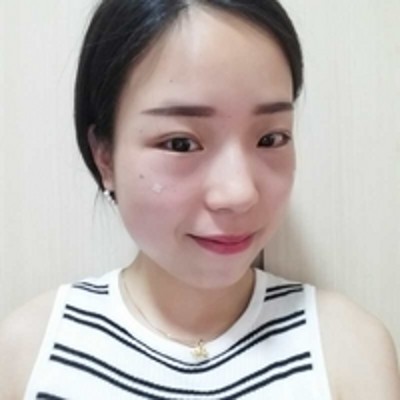 超 声 波去眼袋效果超满意 超 声 波去眼袋效果超满意