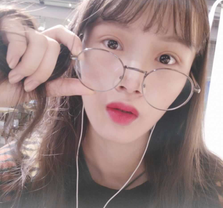 超声波双眼皮给了我女神般的容貌413 超声波双眼皮给了我女神般的容貌413
