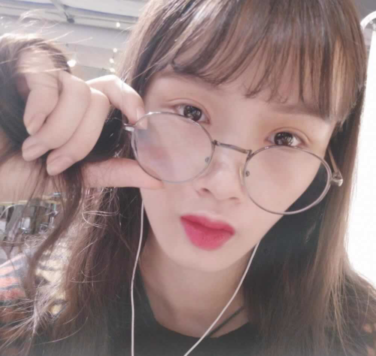 超声波双眼皮给了我女神般的容貌413 超声波双眼皮给了我女神般的容貌413