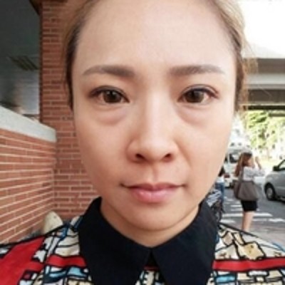 不开刀去眼袋,我又是那个漂漂亮亮的小美女了297 不开刀去眼袋,我又是那个漂漂亮亮的小美女了297