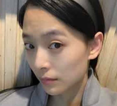 不开刀去眼袋,熬夜我也不怕长眼袋了!978 不开刀去眼袋,熬夜我也不怕长眼袋了!978