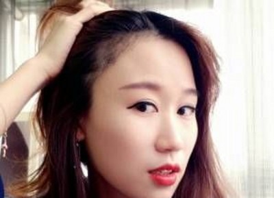 不开刀双眼皮可以让我变得的如此完美403 不开刀双眼皮可以让我变得的如此完美403