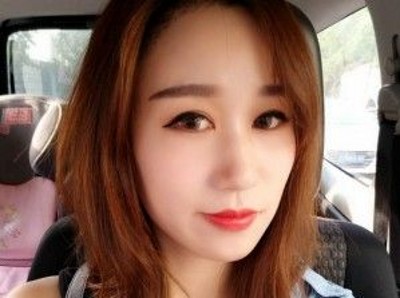 不开刀双眼皮可以让我变得的如此完美403 不开刀双眼皮可以让我变得的如此完美403