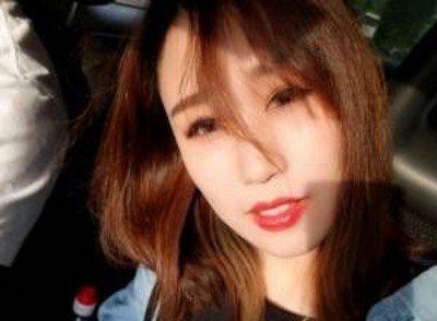 不开刀双眼皮可以让我变得的如此完美403 不开刀双眼皮可以让我变得的如此完美403