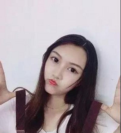 不开刀双眼皮为我的颜值加分!774 不开刀双眼皮为我的颜值加分!774