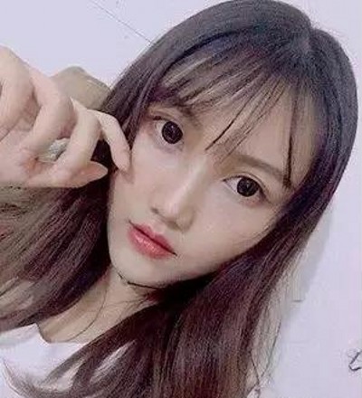 不开刀双眼皮为我的颜值加分!774 不开刀双眼皮为我的颜值加分!774