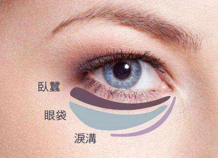 你的眼袋真的需要做掉啦——不动刀去眼袋手术192 你的眼袋真的需要做掉啦——不动刀去眼袋手术192