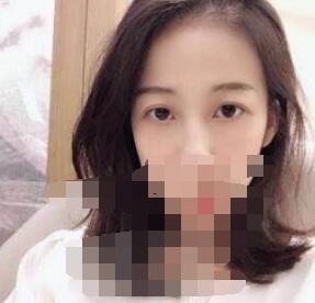 做le超 声 波去眼袋后人变得自信很多le 做le超 声 波去眼袋后人变得自信很多le
