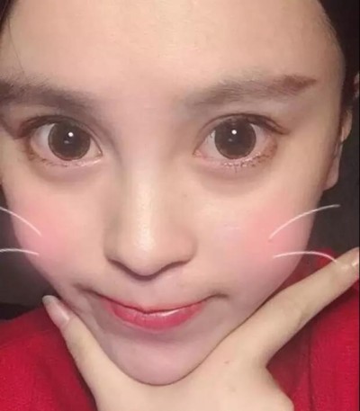 超声波双眼皮让我变得美丽出众566 超声波双眼皮让我变得美丽出众566