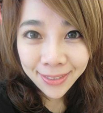 超声波去眼袋让我的眼睛更有神了004 超声波去眼袋让我的眼睛更有神了004