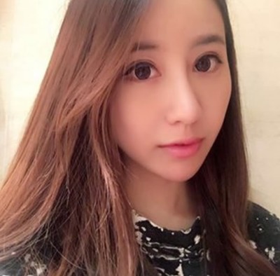 超声波双眼皮让我更加的精致863 超声波双眼皮让我更加的精致863