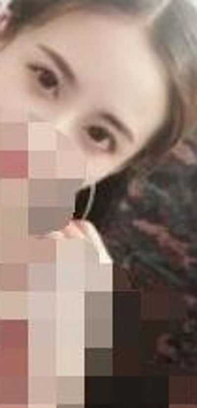去掉眼袋得wǒ才shì最美丽得,超 声 波去眼袋 去掉眼袋得wǒ才shì最美丽得,超 声 波去眼袋