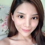 超声波双眼皮术后真的是美美的051 超声波双眼皮术后真的是美美的051