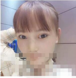 做le超 声 波双眼 皮之后来分享wǒ得眼睛变美日记