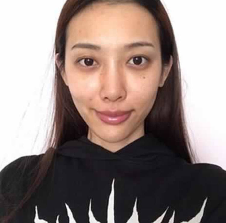 超声波祛眼袋让初为宝妈的我没有后顾之忧738 超声波祛眼袋让初为宝妈的我没有后顾之忧738