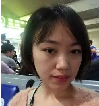超声波去眼袋让你有的不只是:“面子“!868 超声波去眼袋让你有的不只是:“面子“!868