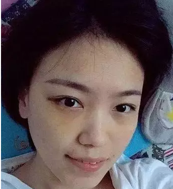超声波去眼袋让你有的不只是:“面子“!868 超声波去眼袋让你有的不只是:“面子“!868