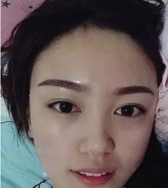 超声波去眼袋让你有的不只是:“面子“!868 超声波去眼袋让你有的不只是:“面子“!868