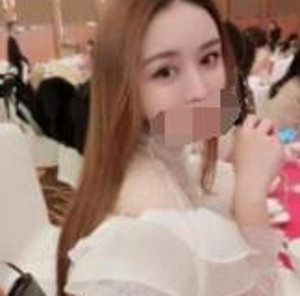 做了超声波双眼皮之后的心得分享747 做了超声波双眼皮之后的心得分享747
