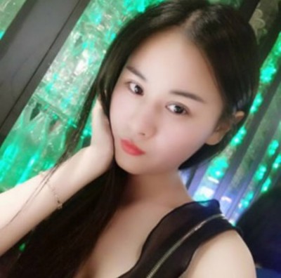 超声波双眼皮修复了我的双眼皮，整个人都变漂亮了659
