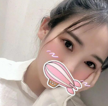 【双眼皮手术】前男友邀请我参加婚礼！该如何不动声色的砸场子？449