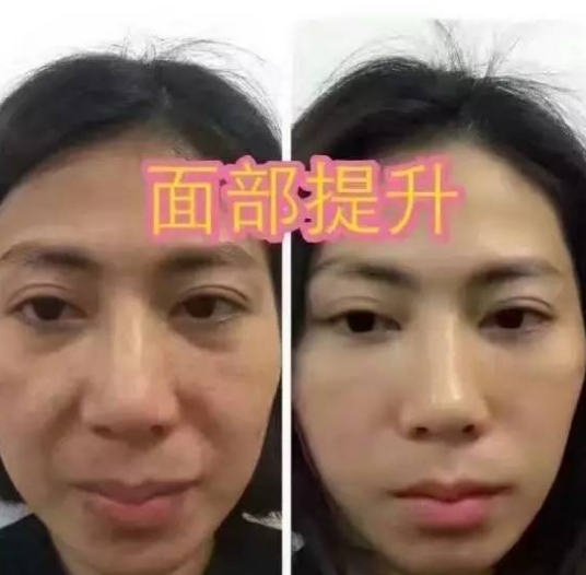 　　优越的下颌线条,脸上自然是不带任何的衰老