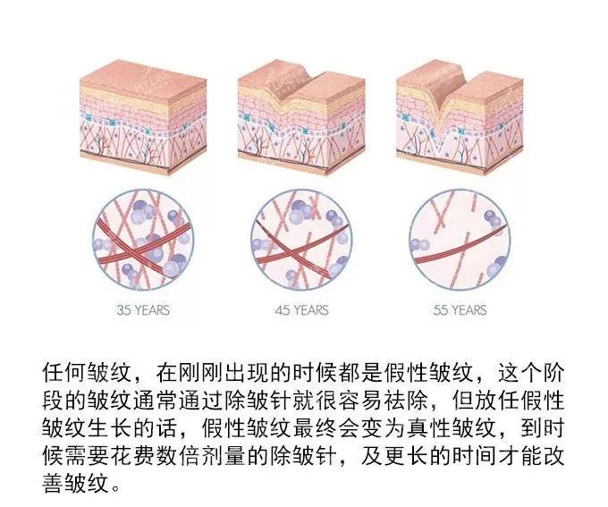 史上最矮环球小姐，72岁却宛如27岁少女：果然面部提升术牛！634