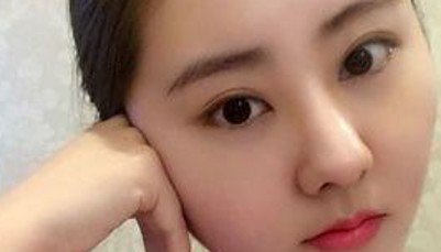 长眼袋变老了，超声波去眼袋让我享受青春的快乐160