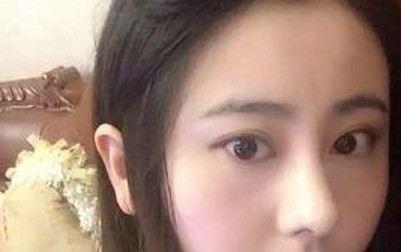 长眼袋变老了，超声波去眼袋让我享受青春的快乐160