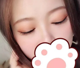 有了双眼皮之后感觉真的很好779 有了双眼皮之后感觉真的很好779