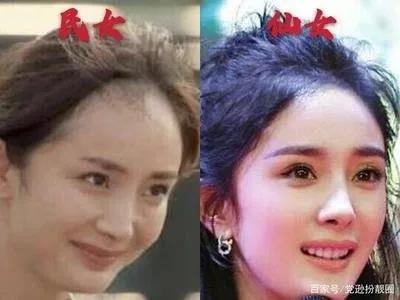 【去眼袋手术】全中国99.9%的人都有的烦恼，来这里立马消除！349