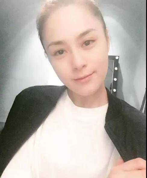 【面部提升术】阿jiao受伤前广告写真曝光！这个颜值状态巅峰啊！