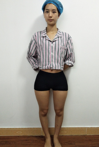 【超声波减肥】瘦下来,人生都开挂了!!!855 【超声波减肥】瘦下来,人生都开挂了!!!855