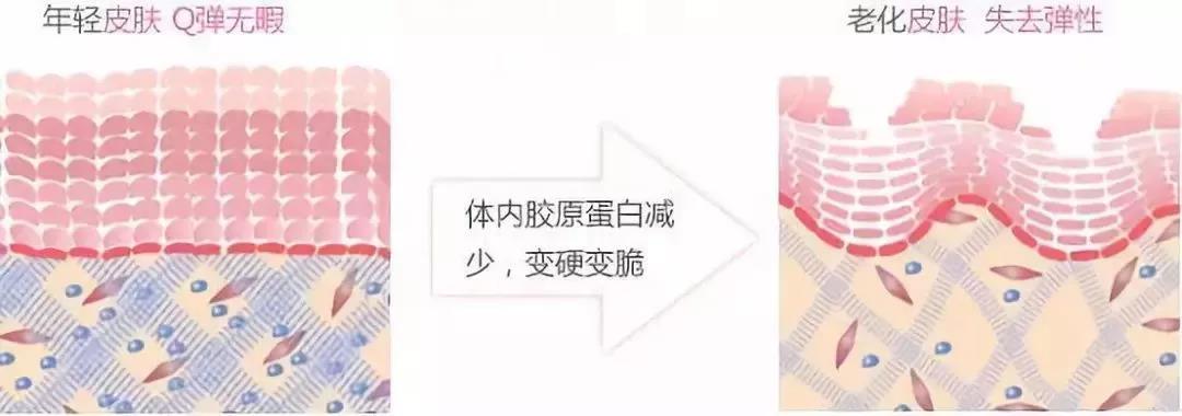 【面部提升术】你所不知道的那些内容~803 【面部提升术】你所不知道的那些内容~803