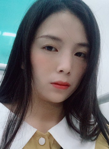 去眼袋手术哪里做最安全?做le手术眼袋会反弹吗? 去眼袋手术哪里做最安全?做le手术眼袋会反弹吗?