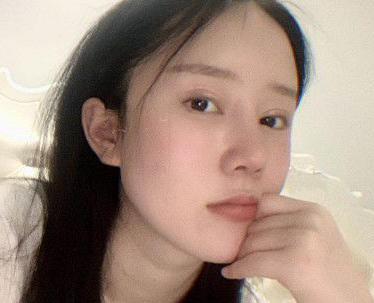 眼部的打造不仅需要精湛医师，技术也很重要！