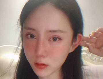 眼部的打造不仅需要精湛医师，技术也很重要！