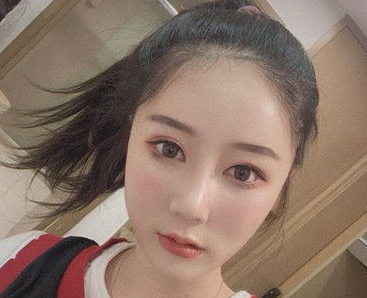 眼部的打造不仅需要精湛医师，技术也很重要！