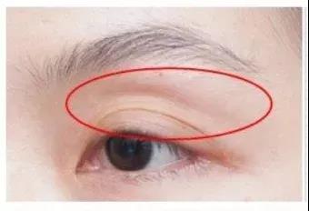 十一小长假怎么整？9命呀！做完双眼皮手术居然显老...