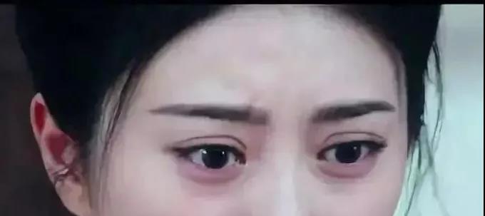 十一小长假怎么整？9命呀！做完双眼皮手术居然显老...