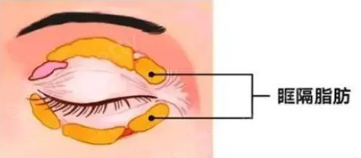 带男朋友ー起去做双眼 皮手术shì什么验？