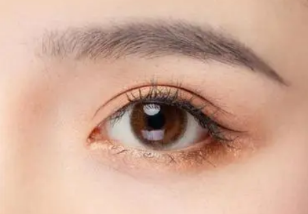 带男朋友ー起去做双眼 皮手术shì什么验？
